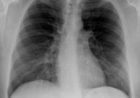 Radiologia domiciliare in collaborazione con team polispecialistico