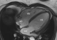 La Risonanza Magnetica Cardiaca ( RM cardiaca ) e l'AngioRM vascolare
